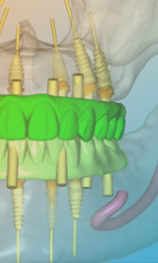 CBCT Boot Camp